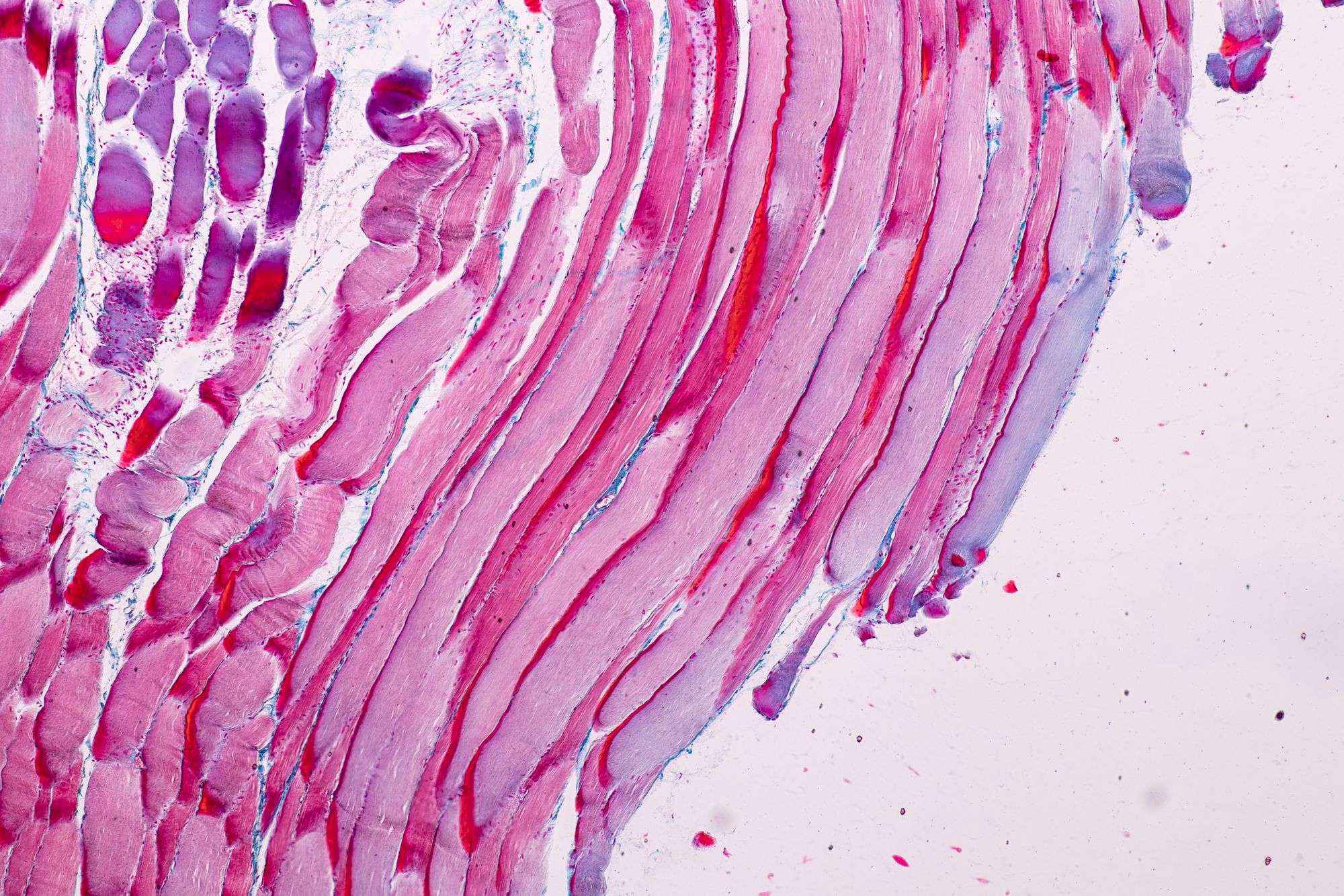 Researchers Repair And Regenerate Heart Muscle Cells researchers-repair-and-regenerate-heart-muscle-cells