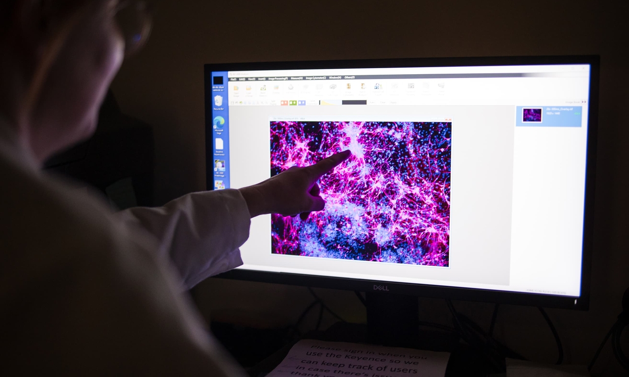 Researchers and clinicians at CHOP and Penn began collaborating to study the feasibility of creating customized gene editing therapies for individual patients in 2023.